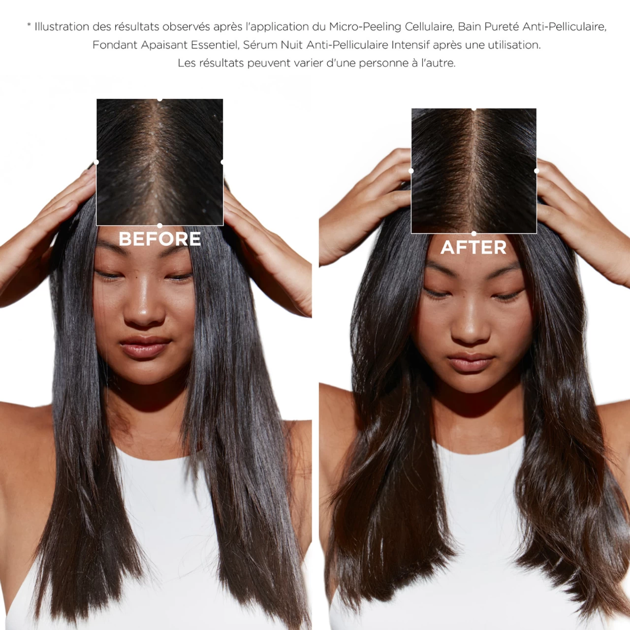 Micro-Peeling Cellulaire Symbiose Kérastase 200ml 3 Micro-Peeling Cellulaire Symbiose Kérastase 200ml – Image 3